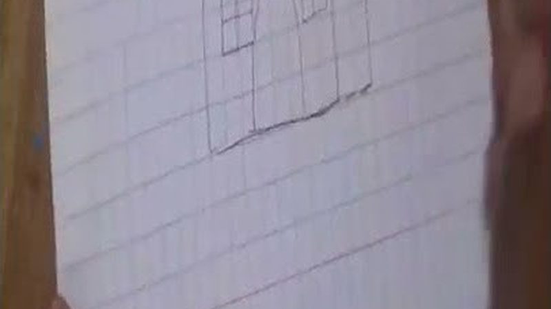 单颗牙齿缺失，种植牙与烤瓷牙，如何选择更合适？**